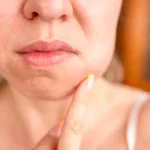 Cum afectează menopauza sănătatea orală. Problemele dentare care pot apărea odată cu schimbările hormonale