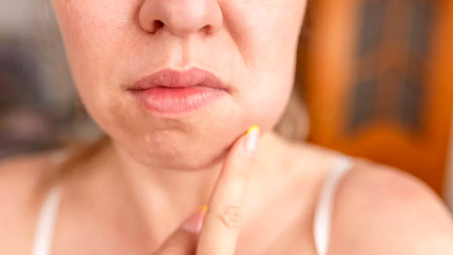 Cum afectează menopauza sănătatea orală. Problemele dentare care pot apărea odată cu schimbările hormonale
