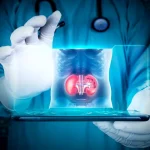Ce trebuie să știe pacienții oncologici pentru a-și menține rinichii sănătoși în timpul tratamentului